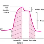 crc_airway_pressure_mechanical_ventilation_es